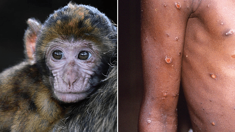 ஆப்பிரிக்காவில் பரவி வரும் குரங்கு பாக்ஸ் நோக்கமாகக் கொண்ட போதைப்பொருள் மீதான நம்பிக்கை.கொடிய வைரஸுக்கு எதிராக முக்கிய மருந்து வேலை செய்யாது, ஆய்வு முடிவுகள்.